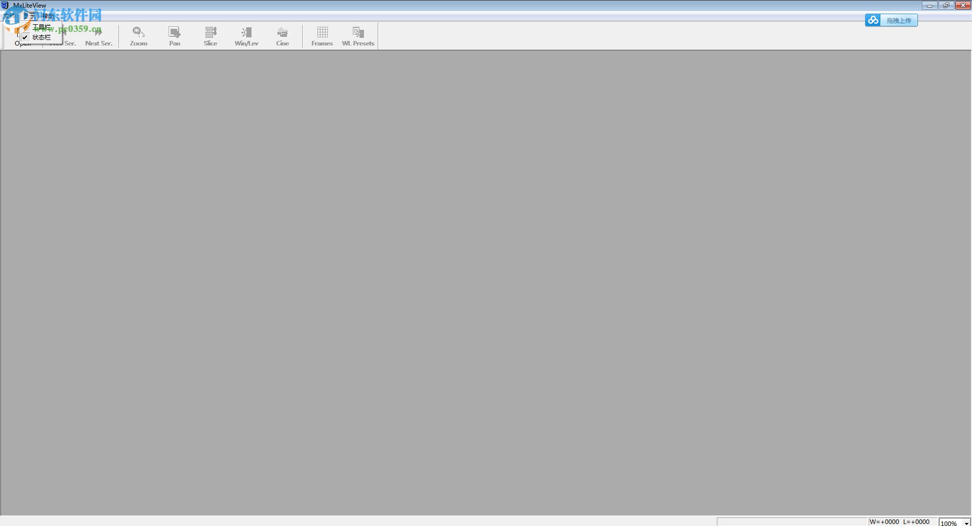 dicom图像浏览器(Philips DICOM Viewer) 1.3 中文绿色版