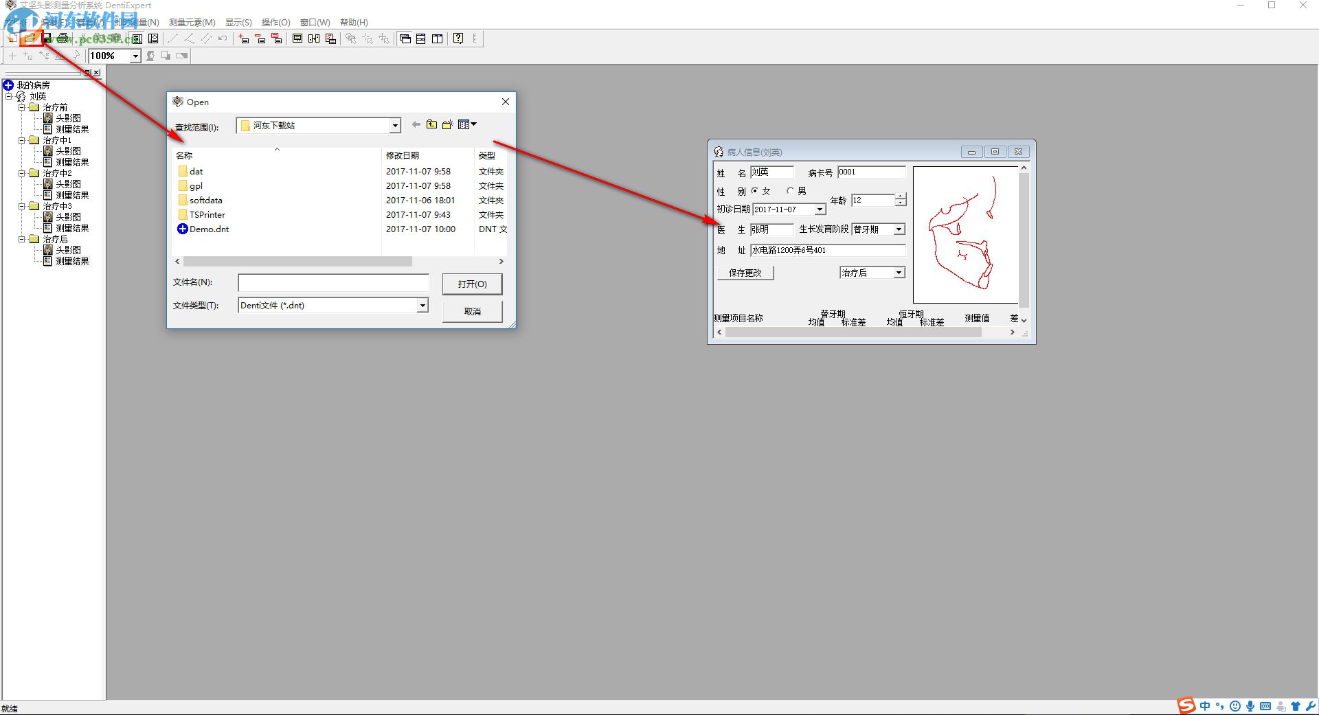 艾坚头影测量分析系统下载(DentiExpert) 2.2 官方版