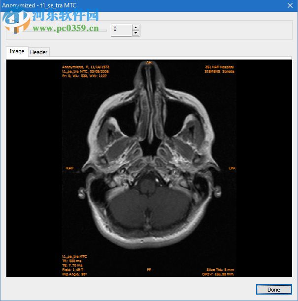 Sante CT Viewer(CT查看软件) 2.2 官方版