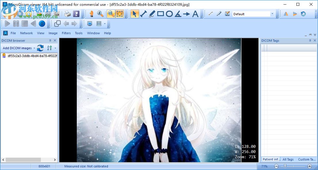 MicroDicom viewer(Dicom格式看图软件) 2.9.2 官方版