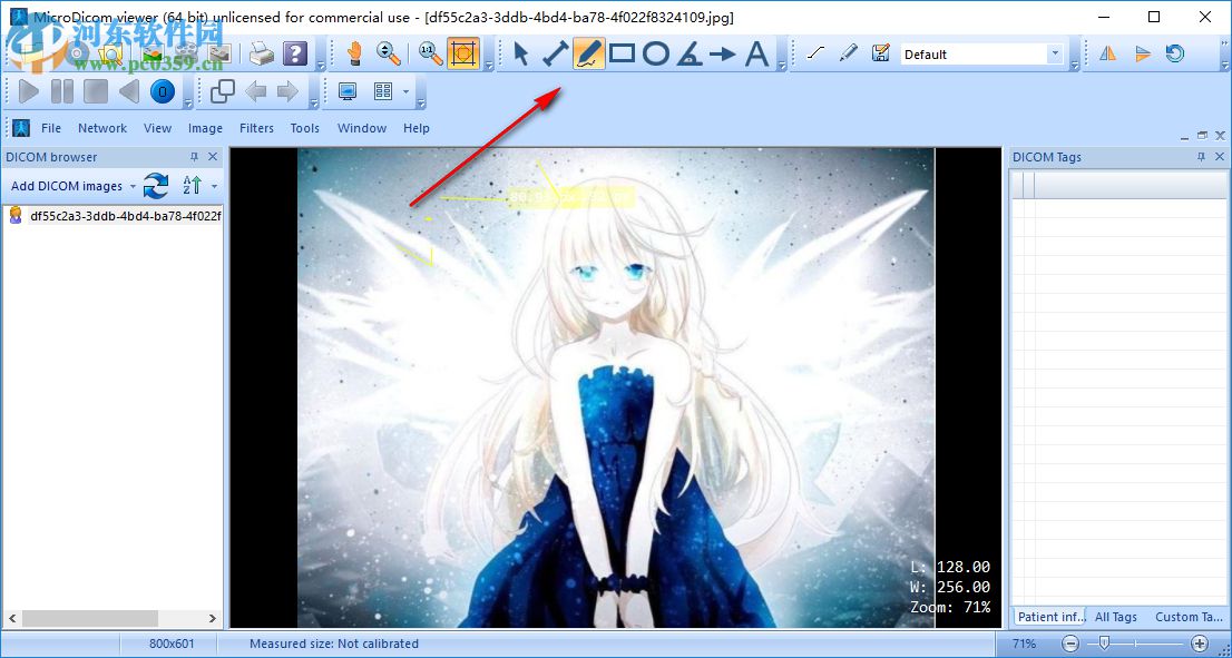 MicroDicom viewer(Dicom格式看图软件) 2.9.2 官方版