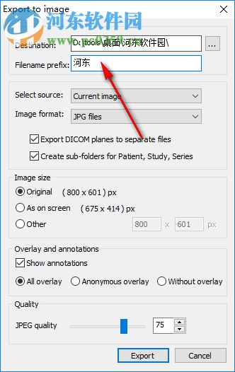 MicroDicom viewer(Dicom格式看图软件) 2.9.2 官方版