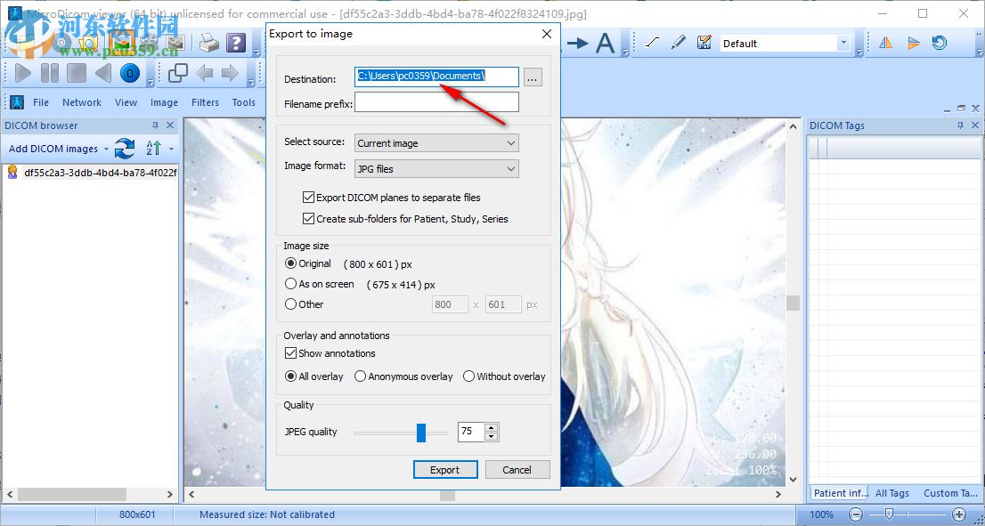 MicroDicom viewer(Dicom格式看图软件) 2.9.2 官方版