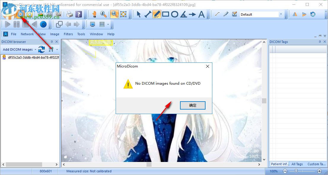 MicroDicom viewer(Dicom格式看图软件) 2.9.2 官方版