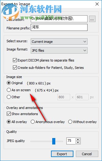 MicroDicom viewer(Dicom格式看图软件) 2.9.2 官方版